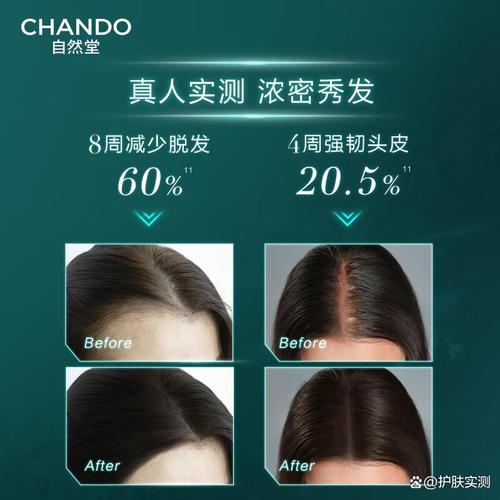 頭皮精華哪個(gè)牌子效果比較好,選擇適合你的護(hù)理方案