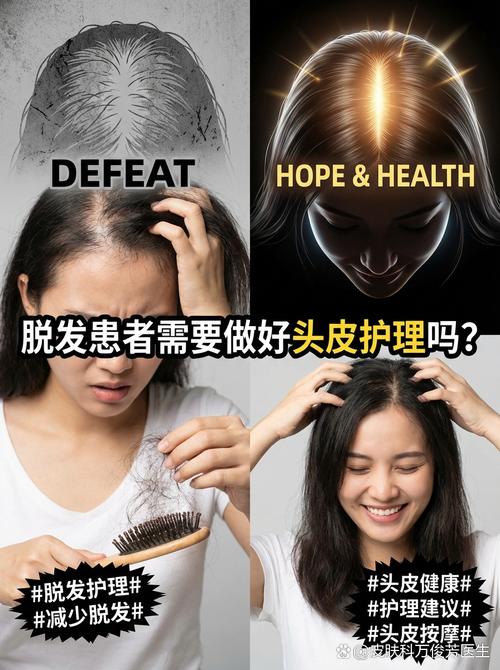 脫發患者需要做好頭皮護理